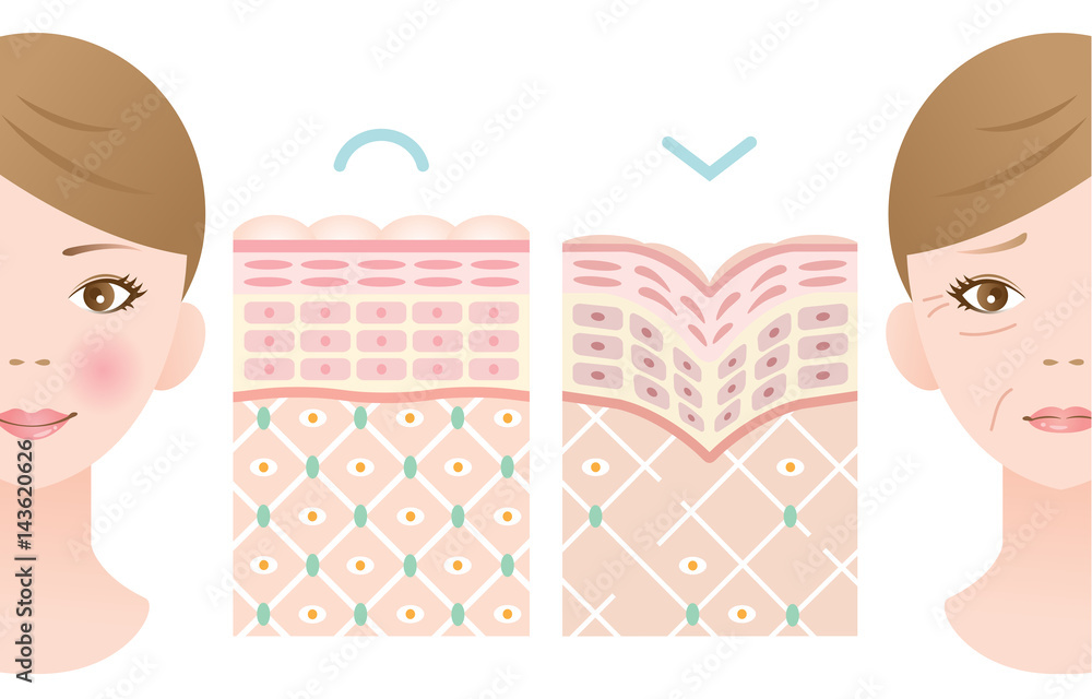 若い肌 しわ肌 断面図 Stock ベクター Adobe Stock