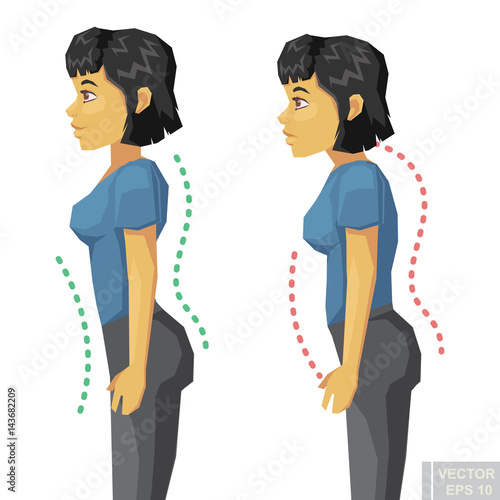 Incorrect standing posture make people have bad personality traits. Flat cartoon woman