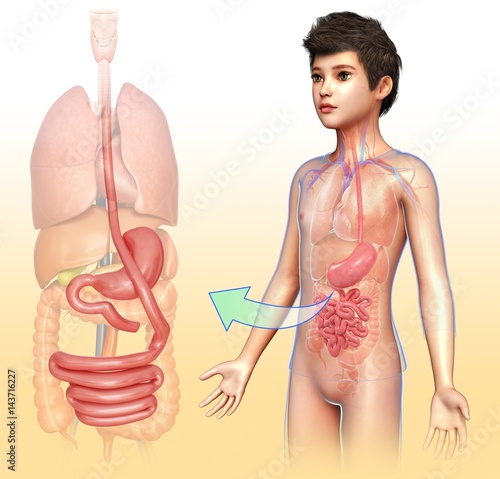 Gastric bypass, illustration photo