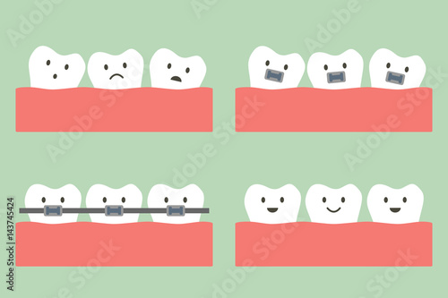 dental orthodontics treatment with teeth braces