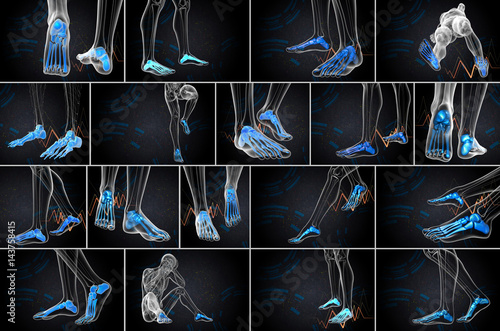 3d rendering medical illustration of the foot bone photo