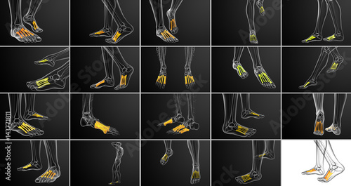 Tableau sur toile 3d rendering medical illustration of the metatarsal bones