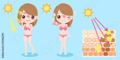 woman with sunburn problem
