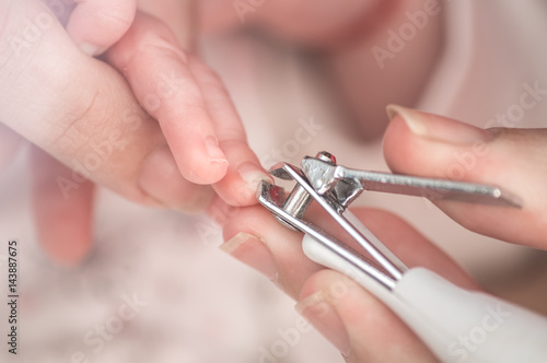 nail trimming in the newborn