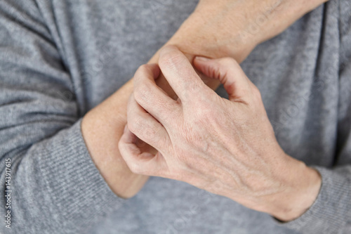 Senior woman scratching arm, close-up photo