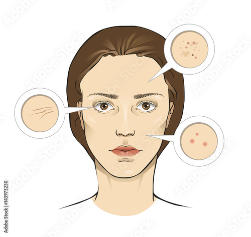 Woman's face vector illustration with skin problems close ups - wrinkles, acne, moles - isolated on white background