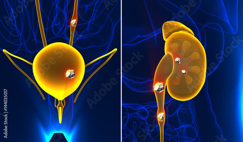 Kidney and urinary stones anatomy pain male internal organ painful cristaline mineral cross section - 3d illustration photo