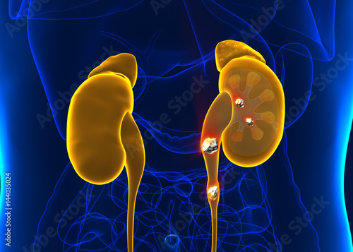 Kidney stones anatomy pain male internal organ painful cristaline mineral cross section - 3d illustration photo