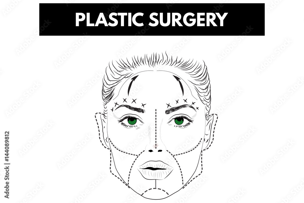 Woman Face With Red lines. Plastic Surgery. Vector illustration. Woman Face With Red lines. Plastic Surgery. Vector illustration.