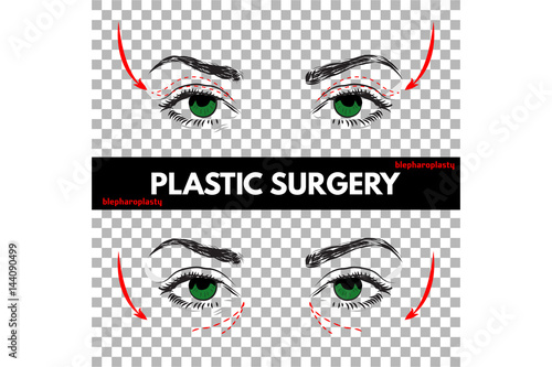 Face Plastic Surgery. Vector Illustration.