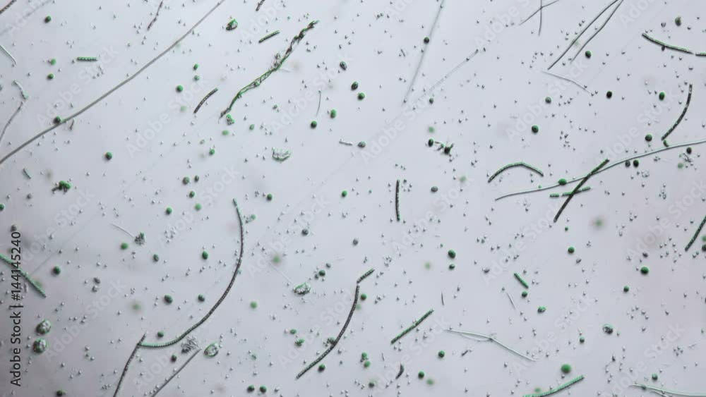 Swamp Bacteria and Protozoa Sample Time Lapse 400x Phase Microscope Swamp Bacteria and Protozoa Sample Time Lapse 400x Phase Microscope