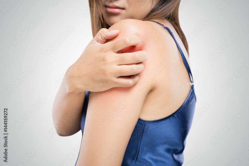 People scratch the itch with hand, Upper arm, itching, Healthcare And Medicine, Beautiful girl woman with skin problem concept People scratch the itch with hand, Upper arm, itching, Healthcare And Medicine, Beautiful girl woman with skin problem concept
