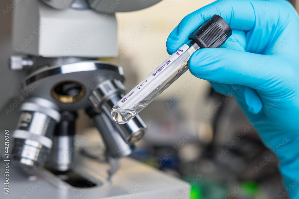 Test tube in the laboratory Test tube in the laboratory