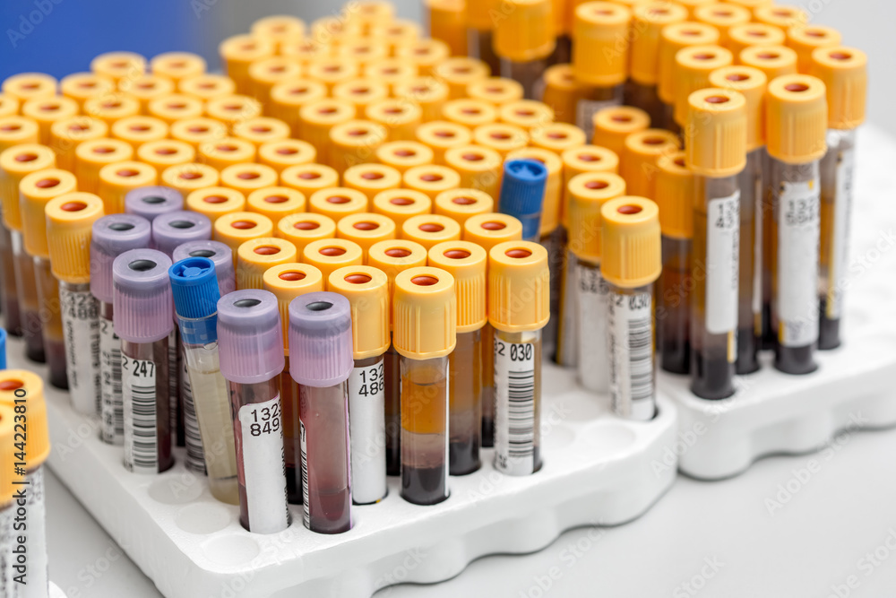 Test tubes Test tubes