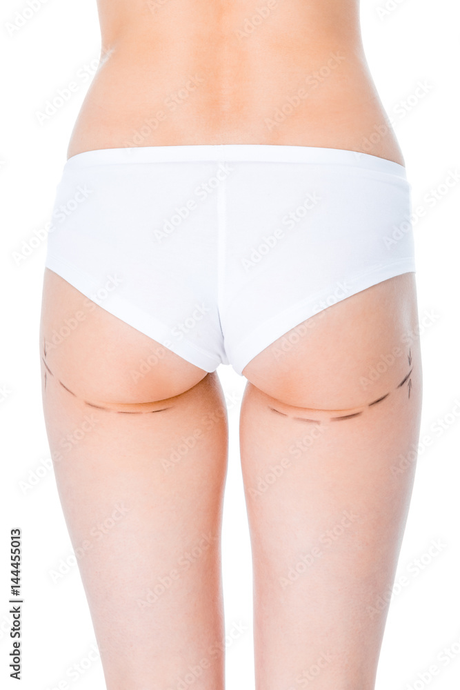woman with correction lines woman with correction lines