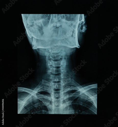 X Ray file of human skull in black background