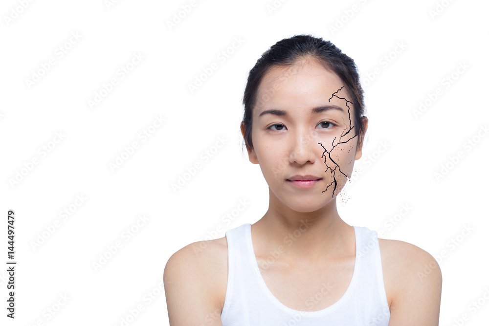 Closeup of woman cracked and damaged face as cosmetic and dehydration effect concept isolated on white background Closeup of woman cracked and damaged face as cosmetic and dehydration effect concept isolated on white background