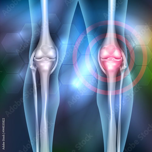 Damaged joint and normal joint colorful design on an abstract grey background