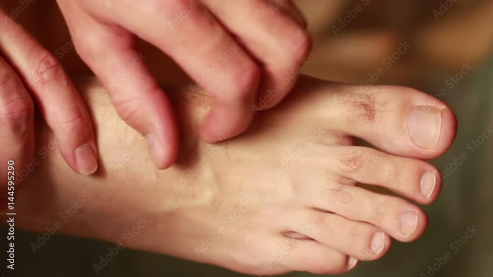 Man scratching inched foot Man scratching inched foot