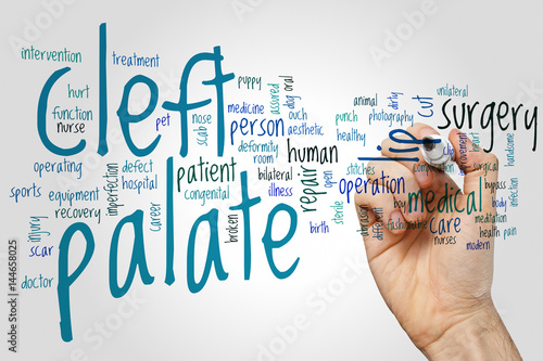 Obraz na plátně Cleft palate word cloud concept on grey background