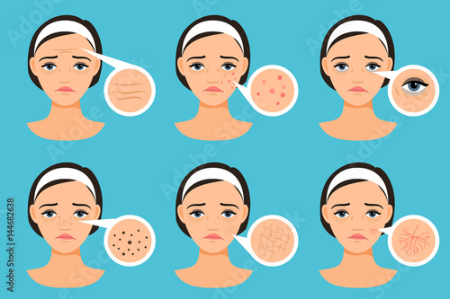 Female face with skin problems