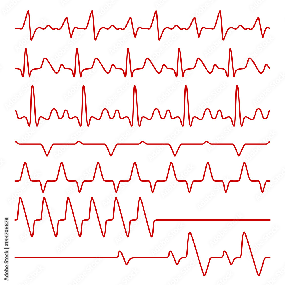 Line vector cardiograms or electrocardiogram on monitor, heartbeat medical symbols