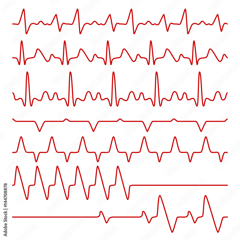 Line vector cardiograms or electrocardiogram on monitor, heartbeat medical symbols Line vector cardiograms or electrocardiogram on monitor, heartbeat medical symbols