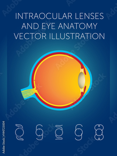 intraocular lenses and eye anatomy vector illustration