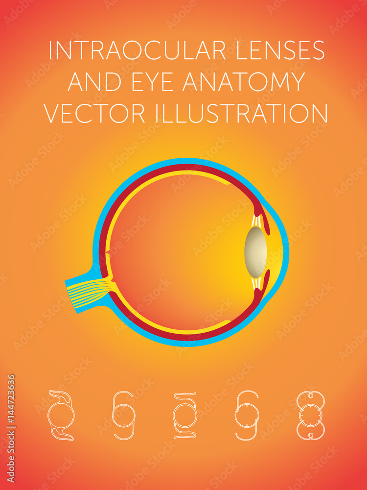 intraocular lenses and eye anatomy vector illustration Stock Vector ...