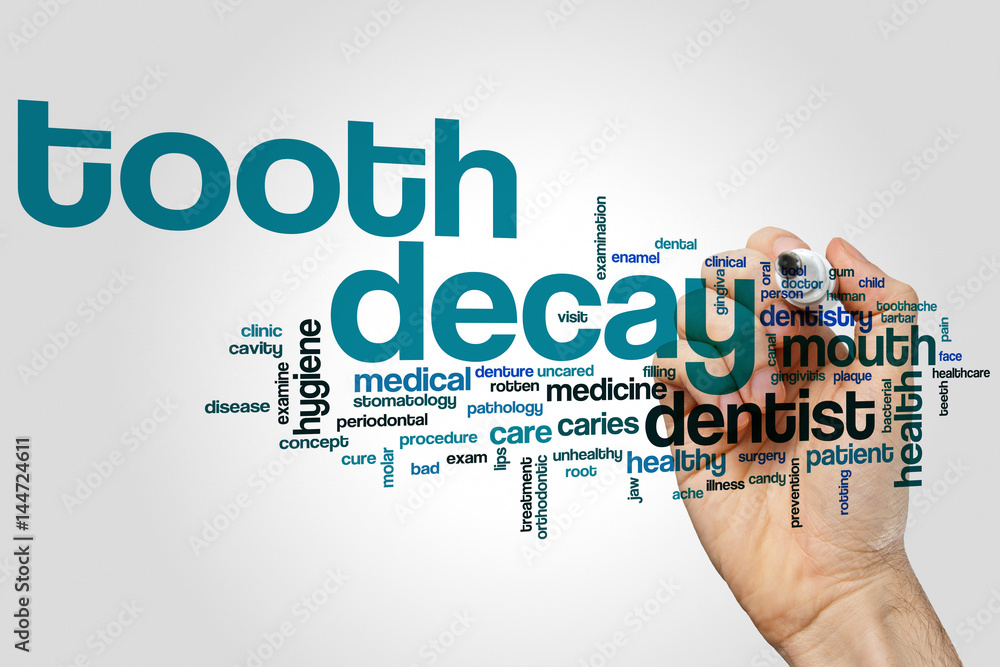 Tooth decay word cloud Tooth decay word cloud