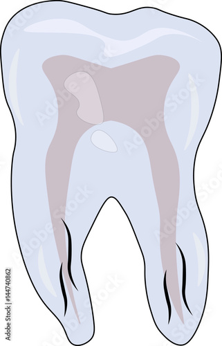 Brush paints over white paint a human tooth.
