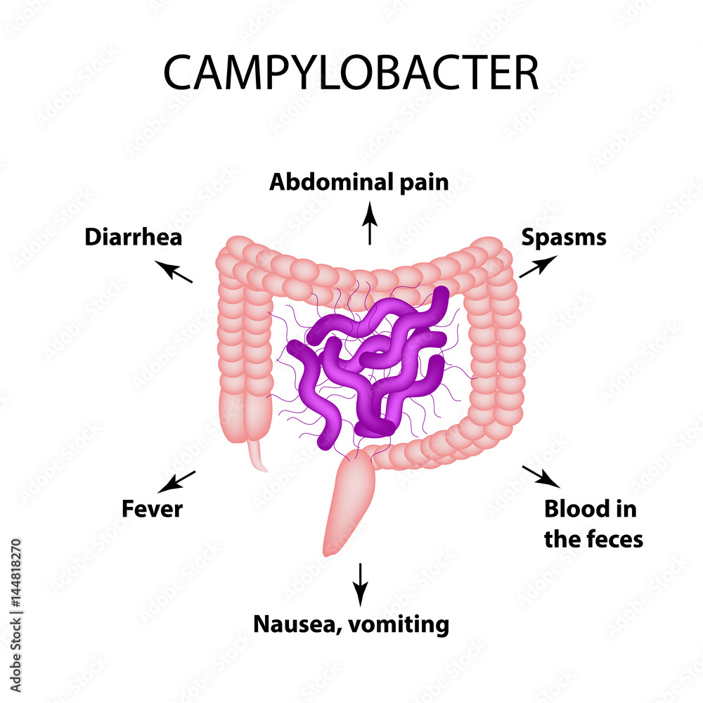 Campylobacter. Pathogenic flora. The bacterium causes intestinal ...