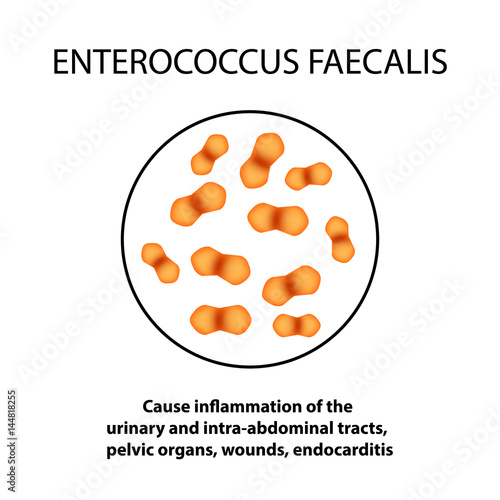 Enterococcus faecalis. Pathogenic flora. The bacterium causes intestinal diseases. Infographics. Vector illustration.