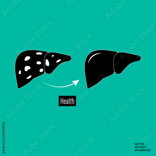 Treatment of liver. Liver disease. cirrhosis