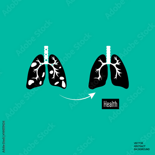 Lungs human body. Disease of the lungs. Anatomy of Medicine