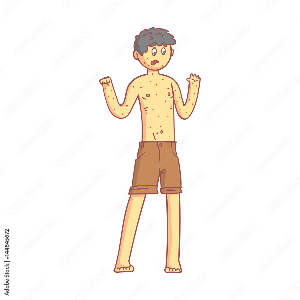 Naked boy teenager with a rash on his body. Colorful cartoon character  Stock Vector | Adobe Stock