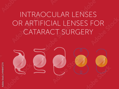 Varieties of intraocular lenses