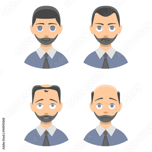 Information chart of hair loss stages types of baldness illustrated on male head vector.