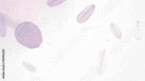 jellyfish_oval_pink_oneshotBG