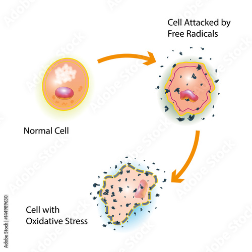 Cell Oxidative Stress