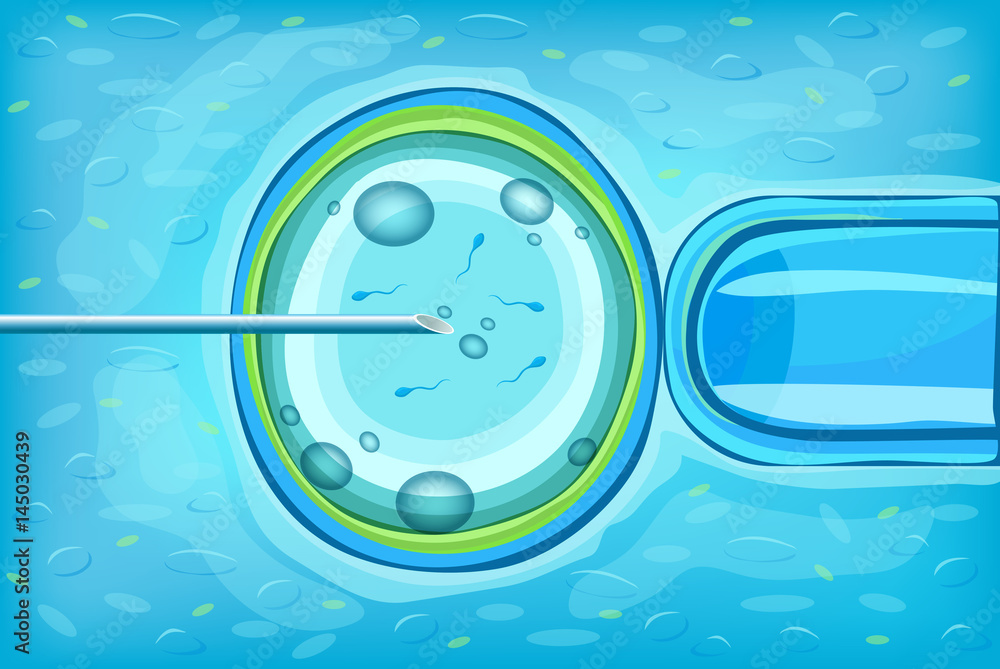 In Vitro Fertilization Scientific Concept