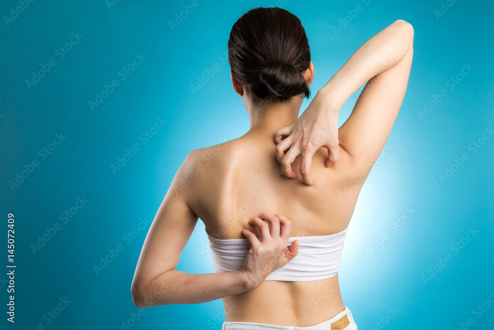 Obraz premium アレルギー・背中を掻く女性