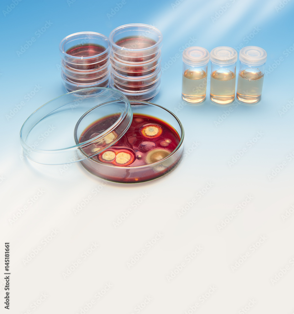 Stacks of dishes and agar cultures with fungal colonies on blue, text space Stacks of dishes and agar cultures with fungal colonies on blue, text space