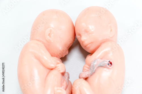 Development of Embryo model, fetus for classroom education. 