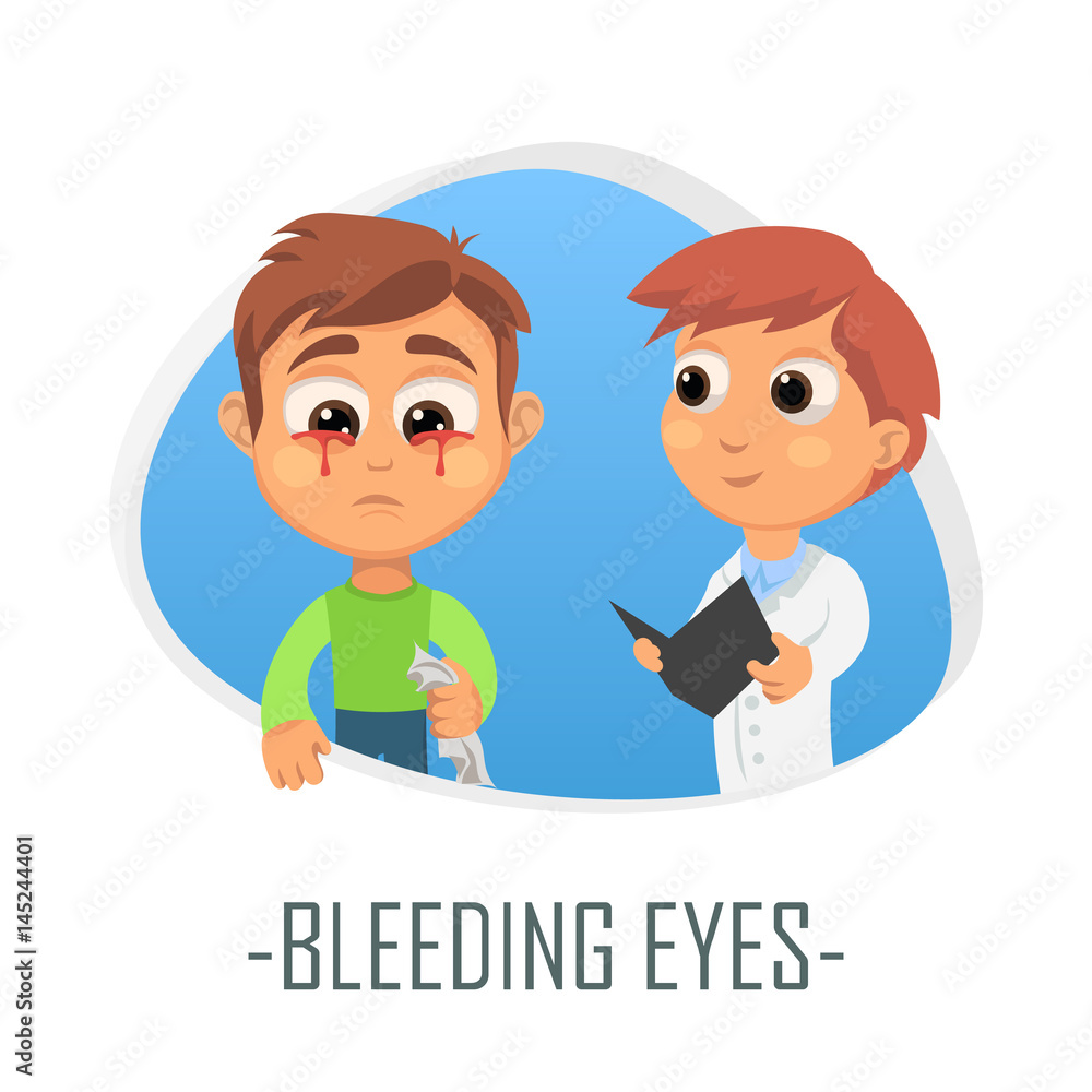 Bleeding eyes medical concept. Vector illustration. Bleeding eyes medical concept. Vector illustration.