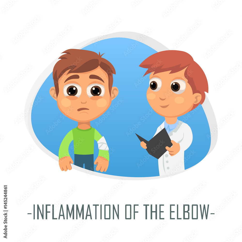 Inflammation of the elbow medical concept. Vector illustration.