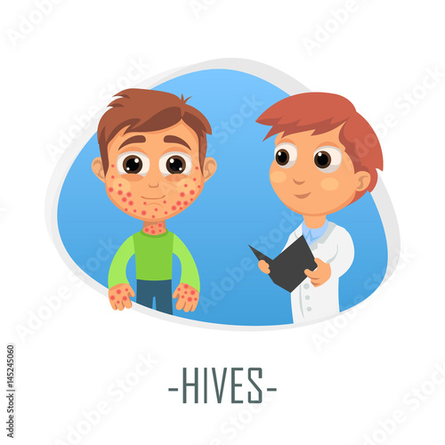 Hives medical concept. Vector illustration.