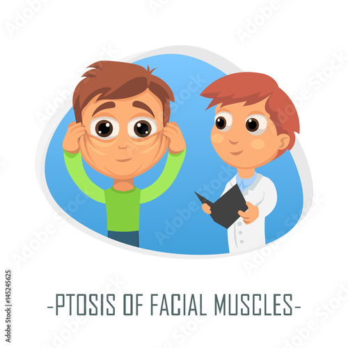 Ptosis of facial muscles medical concept. Vector illustration.