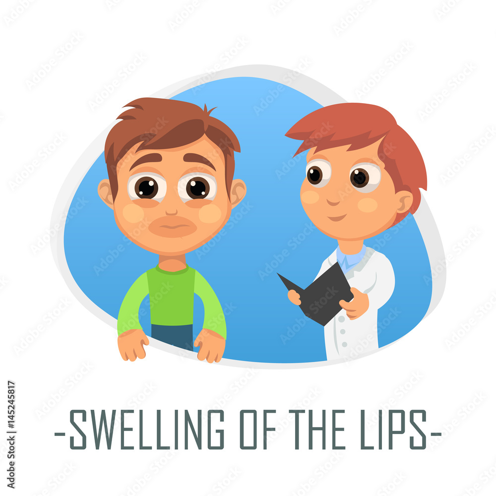 Swelling of the lips medical concept. Vector illustration. Swelling of the lips medical concept. Vector illustration.