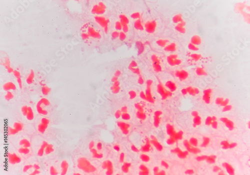 Fotografía gram negative diplococci intracellular